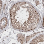 Anti-EXOSC4 Antibody