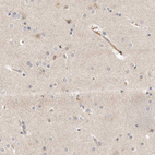 Immunohistochemical staining of human cerebral cortex shows weak cytoplasmic positivity in neurons and endothelial cells.