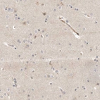 Immunohistochemical staining of human cerebral cortex shows weak cytoplasmic positivity in neurons and endothelial cells.