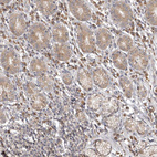 Immunohistochemical staining of human stomach shows weak cytoplasmic positivity in a glandular cells.