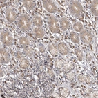 Immunohistochemical staining of human stomach shows weak cytoplasmic positivity in a glandular cells.