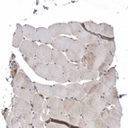 Immunohistochemical staining of human skeletal muscle shows weak cytoplasmic positivity in myocytes.