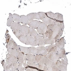 Immunohistochemical staining of human skeletal muscle shows weak cytoplasmic positivity in myocytes.