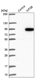 Western blot analysis in control (vector only transfected HEK293T lysate) and KIF2B over-expression lysate (Co-expressed with a C-terminal myc-DDK tag (~3.1 kDa) in mammalian HEK293T cells, LY410047).