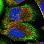 Immunofluorescent staining of human cell line U-2 OS shows localization to plasma membrane & actin filaments.