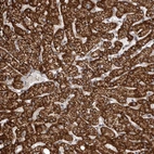 Anti-SNX16 Antibody