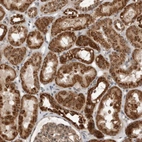 Anti-WDYHV1 Antibody