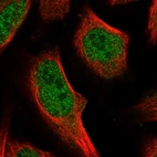 Immunofluorescent staining of human cell line U-2 OS shows localization to nucleoplasm.