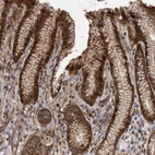 Anti-XKR6 Antibody