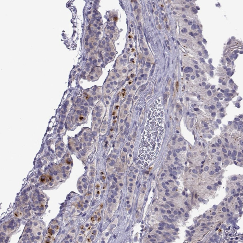 Anti-COL22A1 Antibody