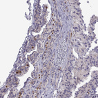 Anti-COL22A1 Antibody