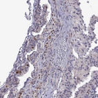 Anti-COL22A1 Antibody