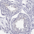 Immunohistochemical staining of human testis shows weak cytoplasmic positivity in a subset of cells in seminiferous ducts.