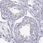 Immunohistochemical staining of human testis shows weak cytoplasmic positivity in a subset of cells in seminiferous ducts.
