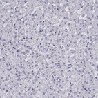 Anti-COL22A1 Antibody
