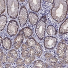 Immunohistochemical staining of human stomach shows moderate cytoplasmic positivity in glandular cells.