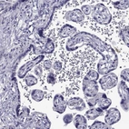 Immunohistochemical staining of human placenta shows no positivity in trophoblastic cells as expected.