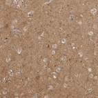 Anti-CUEDC1 Antibody