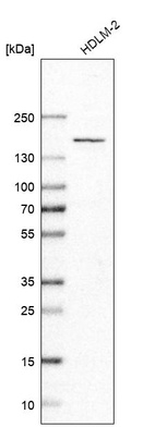 Western blot analysis in human cell line HDLM-2.