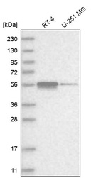 Western blot analysis in human cell line RT-4 and human cell line U-251 MG.