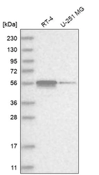Western blot analysis in human cell line RT-4 and human cell line U-251 MG.