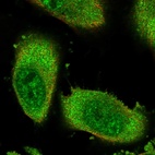 Immunofluorescent staining of human cell line U-251 MG shows localization to nucleoplasm & cytosol.