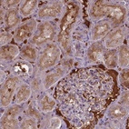 Anti-BTBD17 Antibody