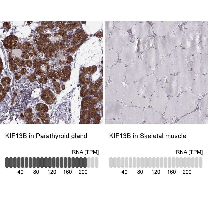 Anti-KIF13B Antibody