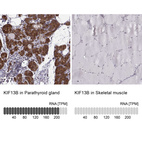 Anti-KIF13B Antibody