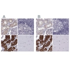 Immunohistochemical staining of human kidney, lymph node, parathyroid gland and skeletal muscle using Anti-KIF13B antibody HPA025023 (A) shows similar protein distribution across tissues to independent antibody HPA049655 (B).
