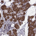 Immunohistochemical staining of human parathyroid gland shows high expression.