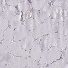 Immunohistochemical staining of human skeletal muscle shows low expression as expected.