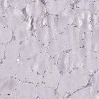 Immunohistochemical staining of human skeletal muscle shows low expression as expected.