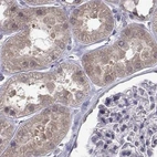 Immunohistochemical staining of human kidney using Anti-KIF13B antibody HPA025023.