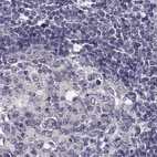 Immunohistochemical staining of human lymph node using Anti-KIF13B antibody HPA025023.
