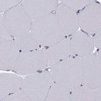Immunohistochemical staining of human skeletal muscle using Anti-KIF13B antibody HPA025023.