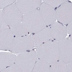 Immunohistochemical staining of human skeletal muscle using Anti-KIF13B antibody HPA025023.