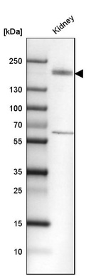 Western blot analysis in human kidney tissue.