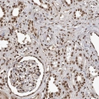 Anti-TGS1 Antibody