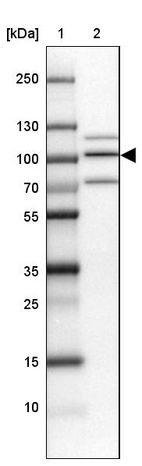 Lane 1: Marker [kDa] 250, 130, 100, 70, 55, 35, 25, 15, 10_br/_Lane 2: Human cell line NTERA-2