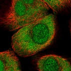Immunofluorescent staining of human cell line A-431 shows localization to nucleus & cytosol.