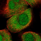 Immunofluorescent staining of human cell line A-431 shows localization to nucleus & cytosol.