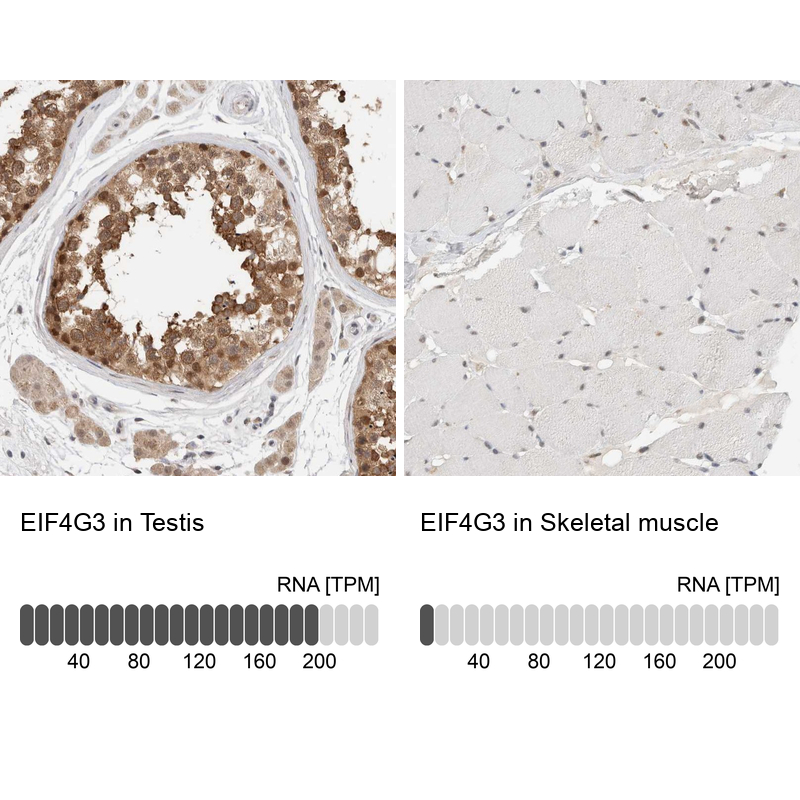 Anti-EIF4G3 Antibody