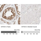 Anti-EIF4G3 Antibody