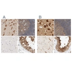 Immunohistochemical staining of human cerebral cortex, lymph node, skeletal muscle and testis using Anti-EIF4G3 antibody HPA025031 (A) shows similar protein distribution across tissues to independent antibody HPA025039 (B).