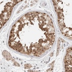 Immunohistochemical staining of human testis shows high expression.