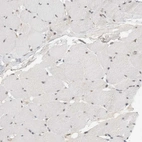 Immunohistochemical staining of human skeletal muscle shows low expression as expected.