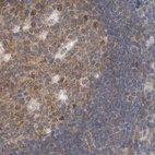 Immunohistochemical staining of human lymph node using Anti-EIF4G3 antibody HPA025031.