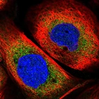 Immunofluorescent staining of human cell line A-431 shows localization to cytosol.