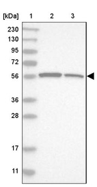 Lane 1: Marker [kDa] 230, 130, 95, 72, 56, 36, 28, 17, 11_br/_Lane 2: Human cell line RT-4_br/_Lane 3: Human cell line U-251MG sp
